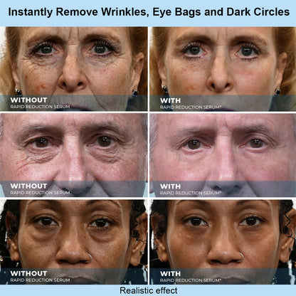 SKINMAGY™ Instant Face Temporary Tightener – Instant visible results in 30 seconds