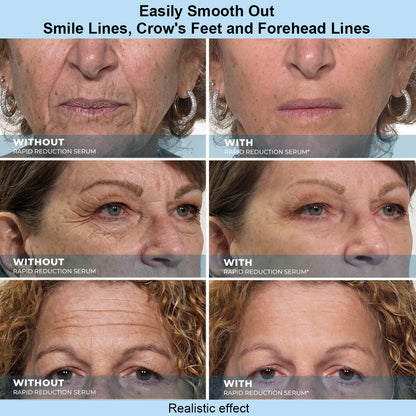 SKINMAGY™ Instant Face Temporary Tightener – Instant visible results in 30 seconds