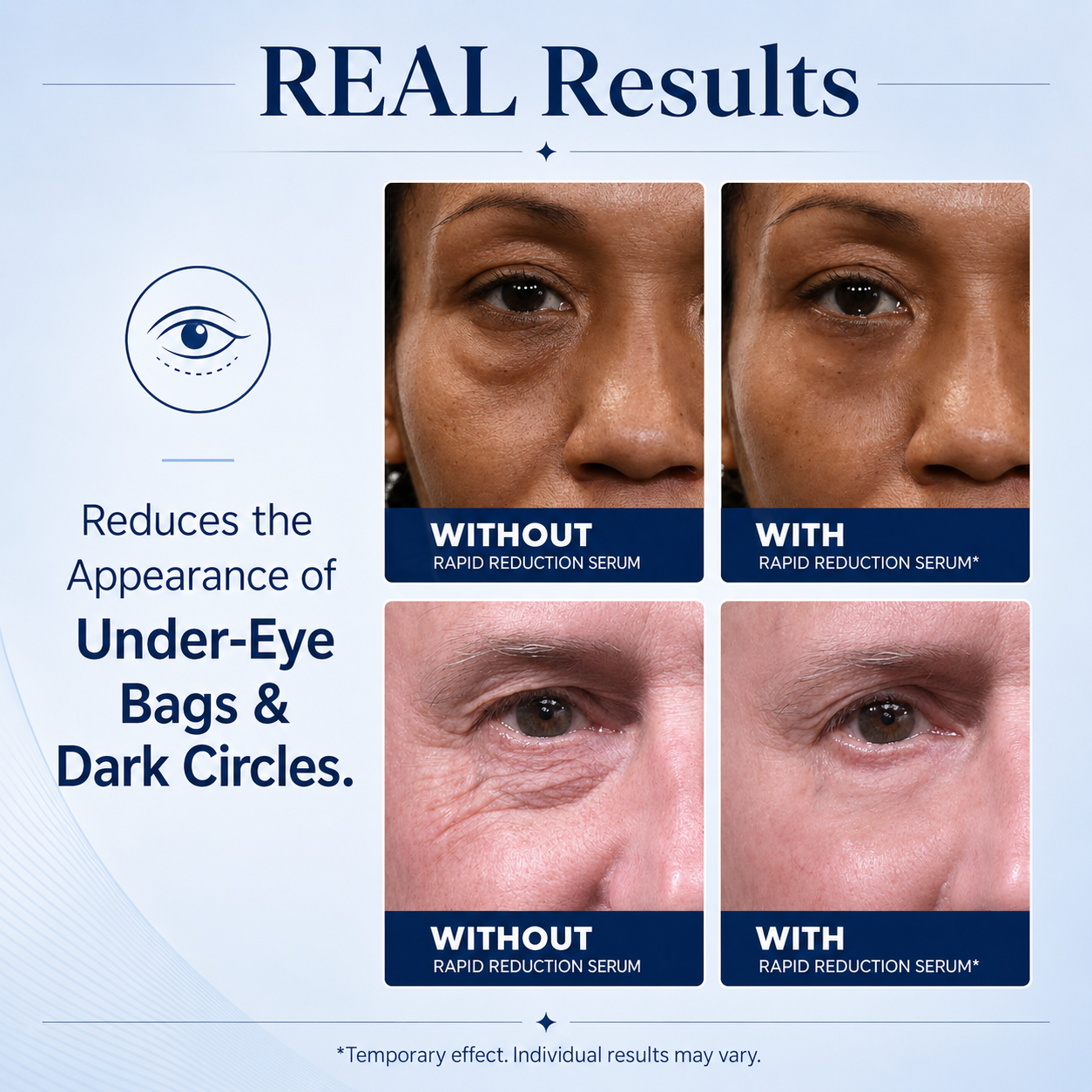 🔥SKINMAGY™ Instant Face Temporary Tightener – Instant visible results in 30 seconds