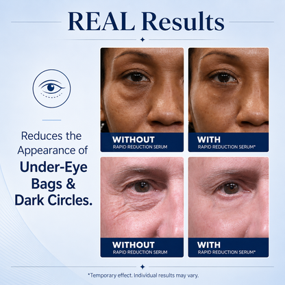 🔥SKINMAGY™ Instant Face Temporary Tightener – Instant visible results in 30 seconds