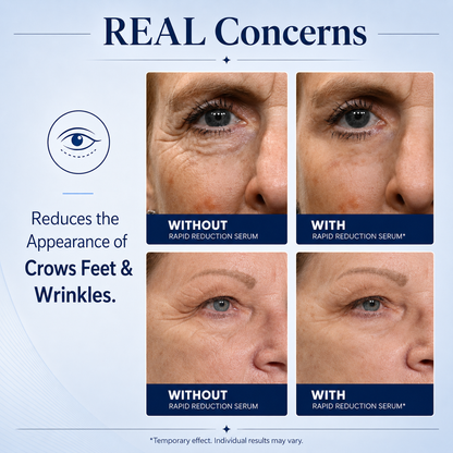 🔥SKINMAGY™ Instant Face Temporary Tightener – Instant visible results in 30 seconds