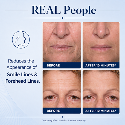 🔥SKINMAGY™ Instant Face Temporary Tightener – Instant visible results in 30 seconds